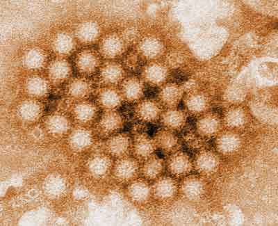 Norovirus particles
