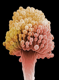 Aspergillus conidiophore and spores, scanning electron micrograph at 8,000 magnification.