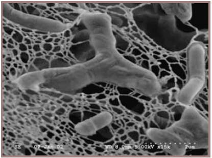 Scanning electron micrograph of Bifidobacterium longum DJO6A, which is an exopolysaccharide-producing human isolate.