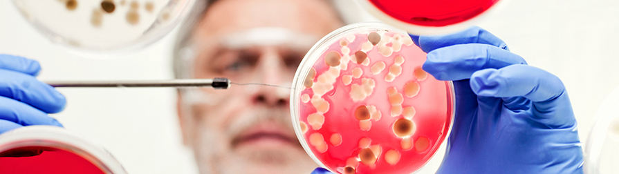 Food Microbiology Division closeup of substance in petri dish