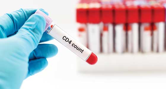Flow cytometry diagnostic tool to count and sort various types of cells.