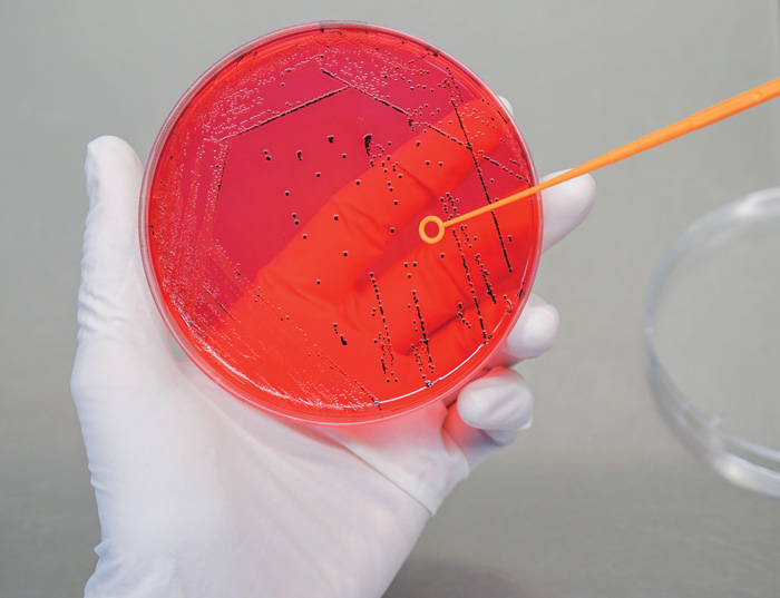 Salmonella in red petri dish