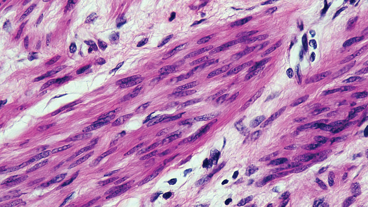 Cross-section of a smooth muscle cell