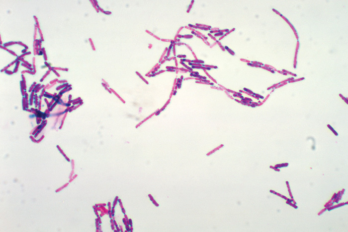 Bacillus cereus 