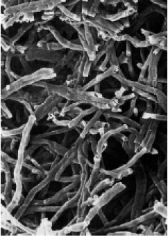 Fig.4—Electron micrograph illustrating the filamentous nature of mycoprotein