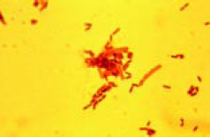 Fig. 3—Apparent symbiotic growth of Listeria monocytogenes (purple cells) and Pseudomonas fragi (pinkish orange cells) forming a biofilm. Photomicrograph taken with epifluorescent microscope. Cells were stained using modified Gram stain. From Sasahara and Zottola (1993).