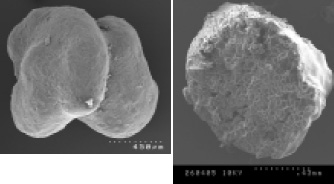 Fig. 1—Scanning electron micrographs of microencapsulated freeze-dried probiotic bacteria. Left, external appearance of two particles; right, cross-section of one particle