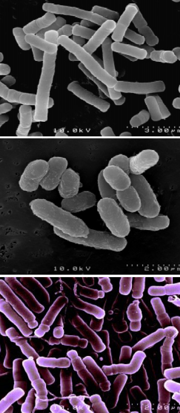 Fig. 2—Strains of probiotics that have been microencapsulated include, from top, L. acidophilus, L. rhamnosus, and B. longum