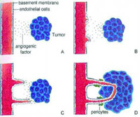 Fig. 1—Key steps in the process of angiogenesis, the formation of new blood vessels from preexisting vascular ones. (A) Secretion of angiogenic stimulus, such as proteases, by the tumor and degradation of the basement membrane. (B) Sprouting, elongation, migration, and proliferation of endothelial cells. (C) Association of endothelial cells into new tubular channels. (D) Synthesis of a new basement membrane and vessel maturation. Adapted from Wernert et al. (1999).