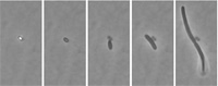 Events occurring during the lag time of an individual spore of nonproteolytic Clostridium botulinum strain Eklund 17B. From left, phase bright dormant spore, phase dark germinated spore, cell that has emerged from the spore, mature cell, and start of a chain of cells. Photos courtesy of Sandra C. Stringer, Martin D. Webb and Michael W. Peck, Institute of Food Research, Norwich, UK.