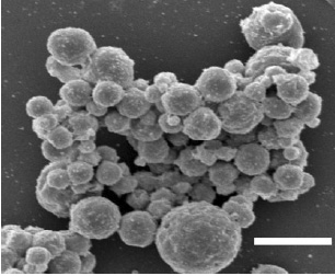 Fig. 2—Scanning electron micrograph of native bovine milk fat globules. Bar is approximately 5 μm.