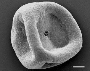 Fig. 3—Milk fat globular membrane. This material was recovered by ultrafiltration and supercritical extraction of the aqueous phase which results from butter production.