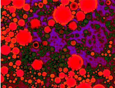 Fig. 4—Confocal microscopic view of multiphase emulsion produced by coacervation for a spray-dried mixed encapsulation system. The emulsion consists of flavor oil droplets (stained with Nile red dye), a polymer-rich coacervate phase coating the lipid droplet (stained with fluorescein dye, green); and an immiscible polymer-poor aqueous phase (shown as purple background). Micrograph courtesy of D. Zasypkin, McCormick & Co., Inc.