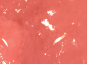 Fig. 4—A marker situated on a cut of beef. The marker was applied in a spray of dilute acetic acid, similar to treatments applied to meat and other carcasses to control the growth of pathogenic bacteria.