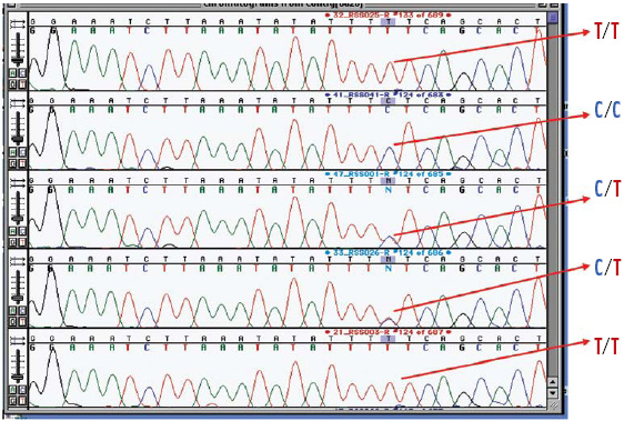 DNA sequencing chromatogram of CYP19 gene of five individuals who are homozygous for thymidine in both alleles (top and bottom), homozygous for cytosine C (end from top) or heterozygous (C/T). Blue is cytosine, red is thymidine, black is guanine, and green is adenosine.