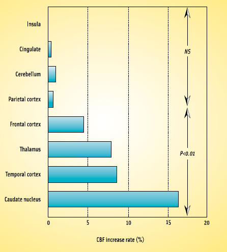 Figure 2. Effect of chewing on blood flow to brain structures. NS = nonsignificant. From Sesay et al. (2000).