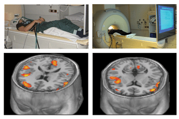 Functional magnetic resonance imaging (fMRI) is employed to measure brain activation in response to food related stimuli.