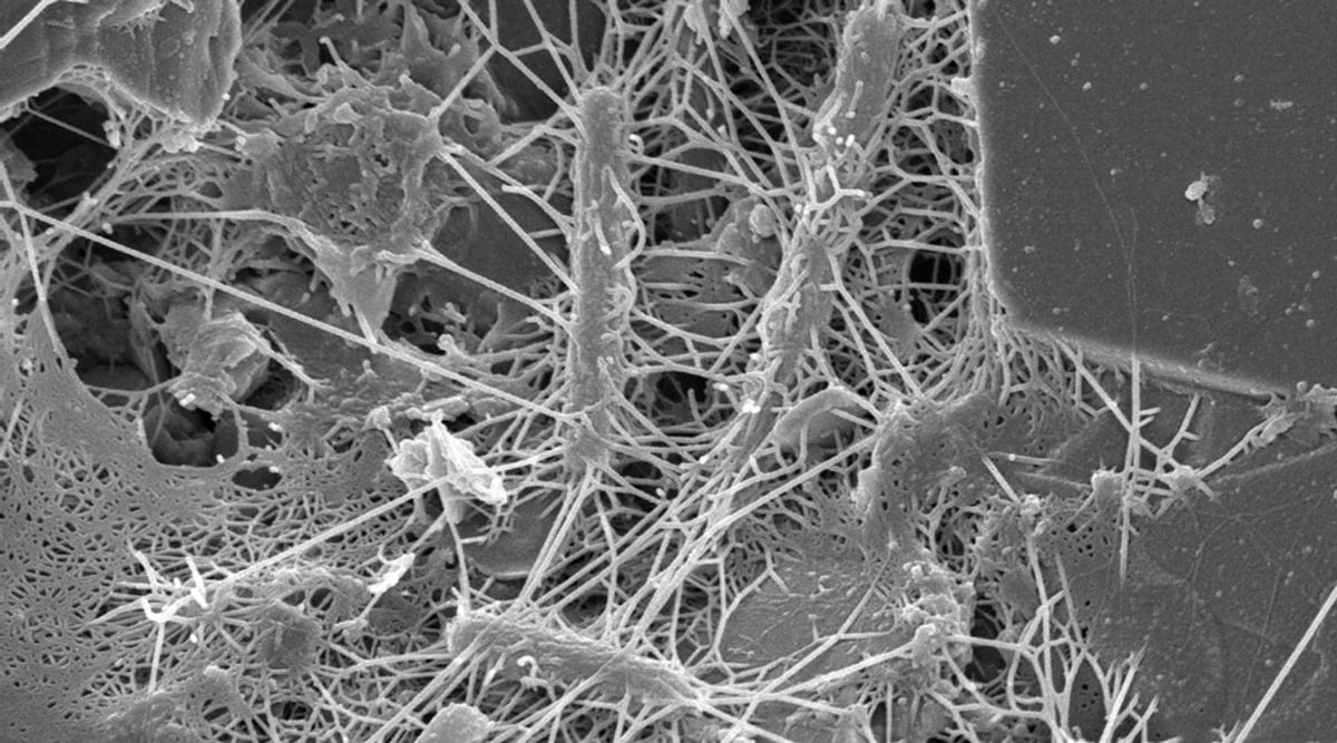 FSQ microscope image