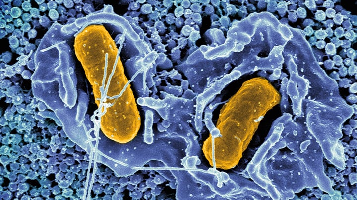 Scanning electron micrograph of Salmonella Typhimurium invading a human epithelial cell.