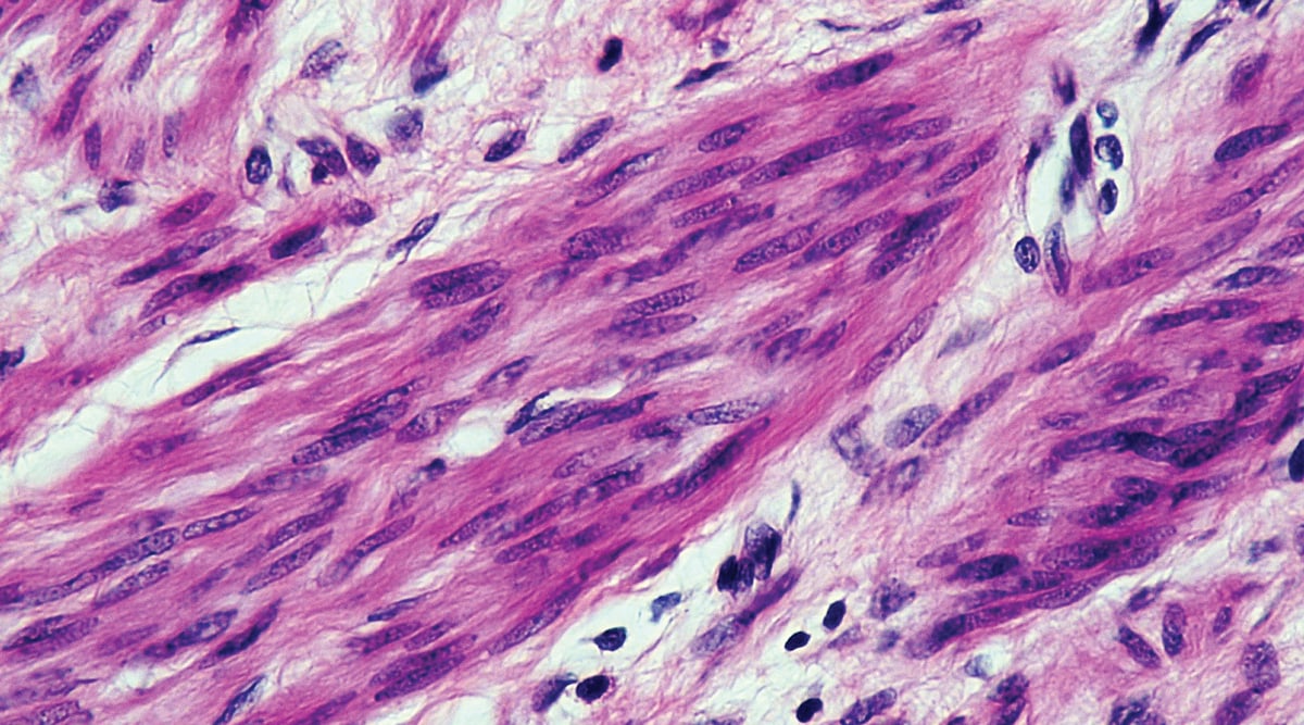 Cross-section of a smooth muscle cell