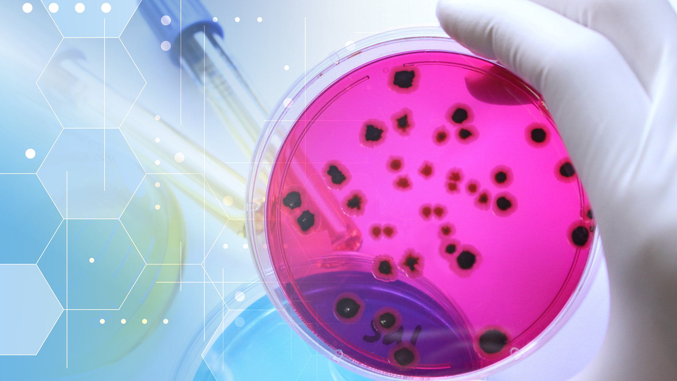 Salmonella in a petri dish