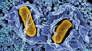 Scanning electron micrograph of Salmonella Typhimurium invading a human epithelial cell.