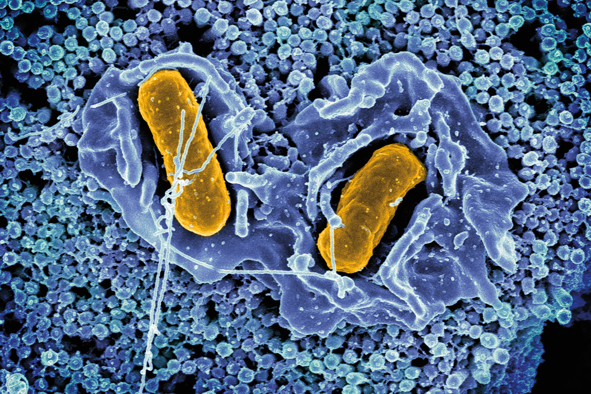 Scanning electron micrograph of Salmonella Typhimurium invading a human epithelial cell.