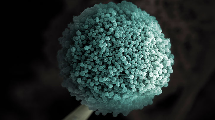 Micrograph